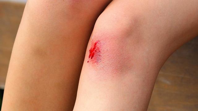 Injured knee with a small bleeding wound.